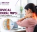 Cervical Epidural MIPSI (Non - Surgical Minimally Invasive Procedure for Neck Pain)