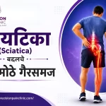 सायटिका (Sciatica) बद्दलचे ४ मोठे गैरसमज आणि वस्तुस्थिती